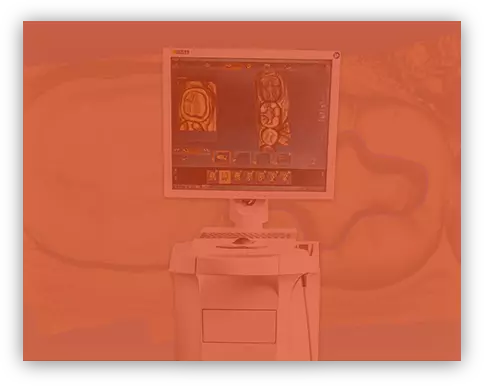 CEREC