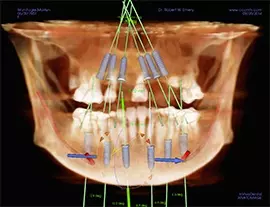 Computer-Guided-Surgery