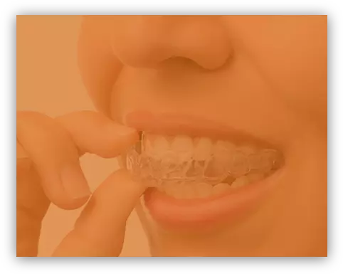 Invisalign™ - Clear Aligners