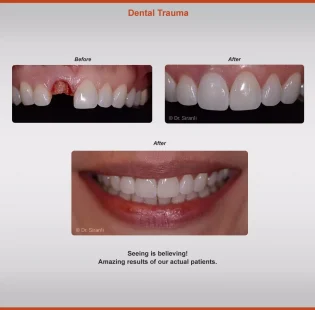 2020-dental-trauma